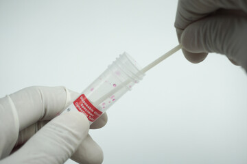 holding disposable virus specimen collection tube. take samples for virus checking
