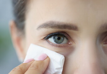 Young woman wipes face with cleaning napkin. Facial hygiene and hydration concept