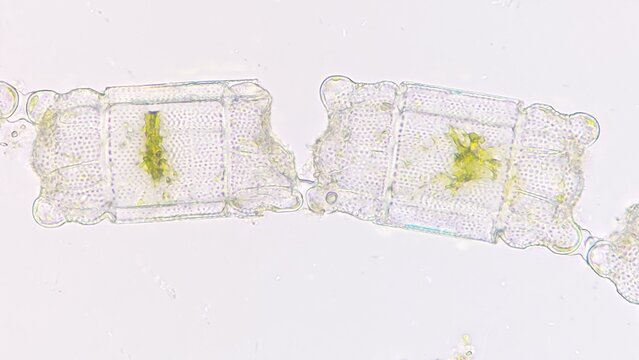 Marine phytoplankton, Biddulphia sp. Live cell. Stacked photo