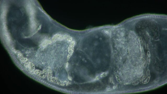Parasitic Trematoda worm under microscope, possibly Brachyphallus crenatus. Stage of development of mature larva is Metacercaria. White sea