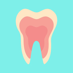 Inflamed tooth, inflamed pulp