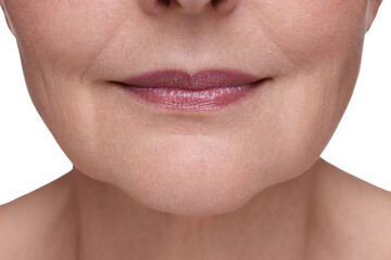 Senior woman with aging skin on white background, closeup. Rejuvenation treatment