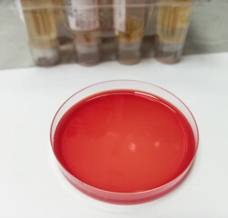 Blood agar plate use to culture fastidious bacteria.