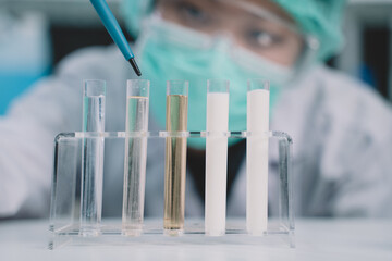 Food scientist testing milk samples of dairy products in the laboratory. Researchers are looking at the stratification of milk.