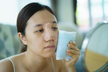 Close up of happy Asian beautiful woman portrait during her face and nose covered by soft splint after have a beauty plastic surgery