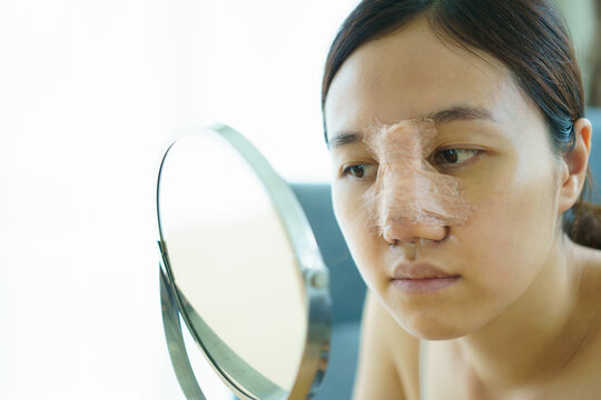 Close Up Of Happy Asian Beautiful Woman Portrait During Her Face And Nose Covered By Soft Splint After Have A Beauty Plastic Surgery