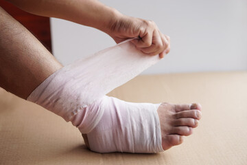 Hand is wrapping bandage around sprain ankle.  Concept, Health care and health problem, accident,...