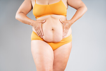 Tummy tuck, flabby skin on a fat belly, plastic surgery concept on gray background