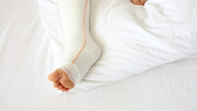 Children's broken leg in orthopedic cast on a white bed in the . Broken leg in cast of an young child