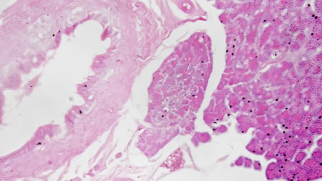 Macro scientific slide of human pancreas tissue magnified under microscope 200 on bright field background. Sample of digestive system organ located in the abdomen. Research of people anatomy concept