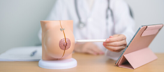 Doctor with Breast Anatomy model. Breast Augmentation Surgery, October Breast Cancer Awareness...