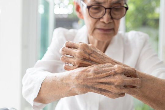 Senior woman with itchy,scratching her arm,dryness and itching,affect of certain medications,dry skin or trigger allergic reactions,irritated skin,skin problem in elderly,health care,medicine concept