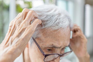 Asian senior woman experiencing an itchy scalp,symptoms of fungal or bacterial infections,diseases...