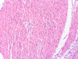 picture of histology human tissue with microscope from laboratory (not Illustration Designation)