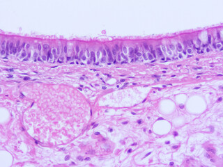 picture of histology human tissue with microscope from laboratory (not Illustration Designation)