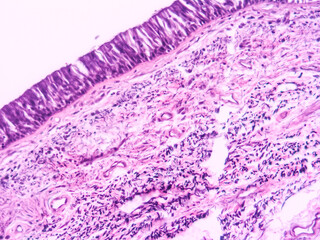 picture of histology human tissue with microscope from laboratory (not Illustration Designation)