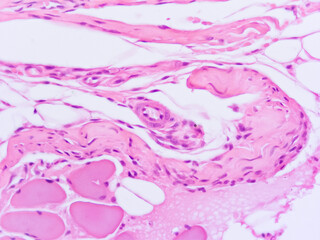 picture of histology human tissue with microscope from laboratory (not Illustration Designation)