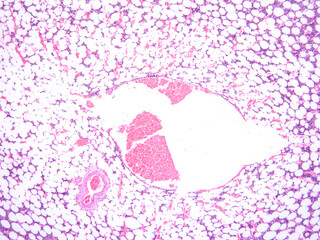 picture of histology human tissue with microscope from laboratory (not Illustration Designation)