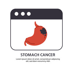 Type of cancer stomach concept. Disease of iternal organ. Medical infographics and educational materials. Digestive system problem. Cartoon flat vector illustration isolated on white background