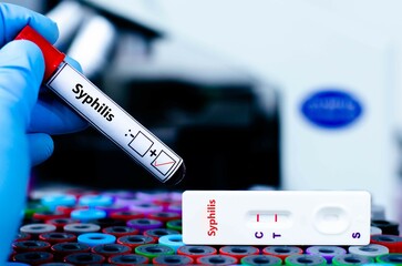 The patient positive tested for syphilis by rapid diagnostic test.