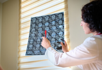 Portrait of young female neurologist or professor consulting a patient, showing MRI slides....