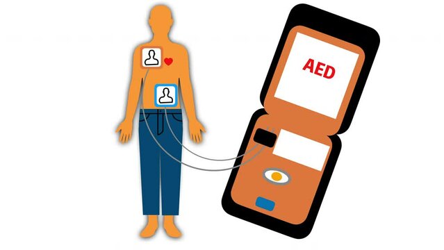 自動体外式除細動器 AED