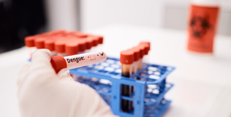 Blood, dengue or hands of scientist in lab with virus and science for innovation, dna and rna...