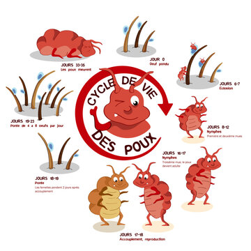 illustration sur le Cycle de vie des poux. Infographie vectorielle. Calques. Texte fran&ccedil;ais