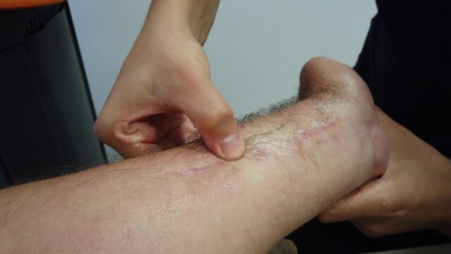 Close Up Therapist using IASTM instrument to treat scapular pain, performing fascia release manipulations soft tissue treatment. IASTM, myofascial Release For Rhomboid And Pain Using Smart Tools,
