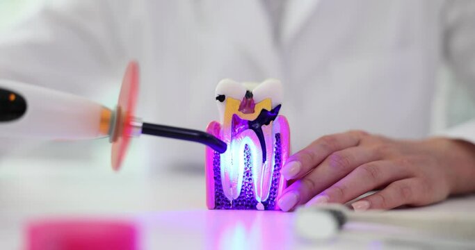 Photopolymer lamp Doctor with a glowing blue lamp and tooth with caries. Dentist, dental treatment prosthetics, puts fillings and treats gum caries