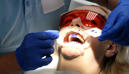 professional teeth cleaning in a dental clinic, removing stones and plaque, young specialists...