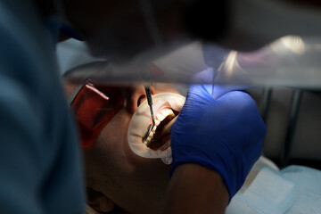 professional teeth cleaning in a dental clinic, removing stones and plaque, young specialists working with a woman, cleaning a saliva ejector, sucking out saliva, applying paint to the teeth - obrazy, fototapety, plakaty