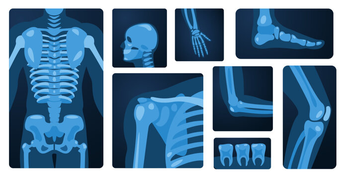 X ray body parts. Human skeleton knee arm chest wrist foot, medical x-ray imaging concept of bone injury. Vector flat set