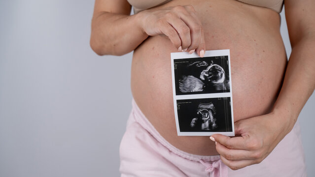 A pregnant woman holds a photo from an ultrasound screening against the background of a bare belly. 