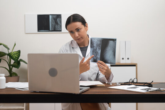 Virtual Medical Discussion: During a telemedicine video call, a doctor presents X-ray films on a laptop screen and elucidates the disease's characteristics to the patient. 