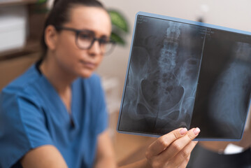 Woman young doctor examines X-ray images of patient pelvis carefully closeup radiologist looks for...