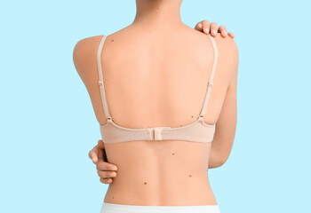 Young woman with moles on blue background, back view