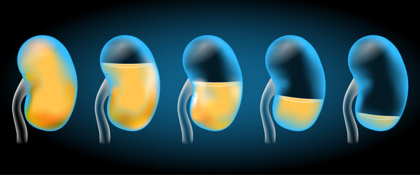 Kidneys and urine. Realistic transparent blue kidney on dark background.