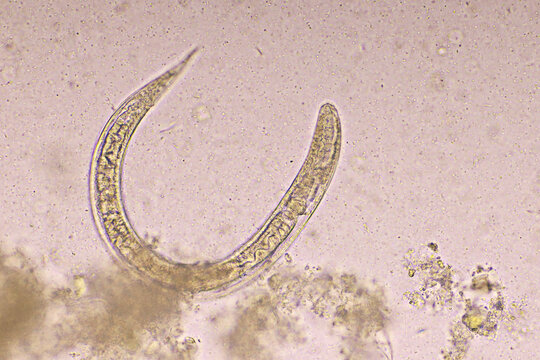 Strongyloides stercoralis or threadworm in human stool, analyze by microscope, original magnification 400x