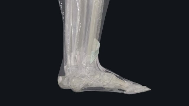 The extensor retinaculum refers to the set of ligaments inside the ankle that connect the tibia and fibula