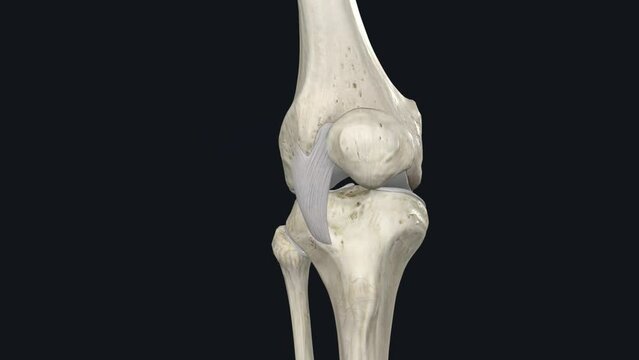The lateral patellar retinaculum (LPR) is located on the anterolateral aspect of the knee joint and extends to the femur transversely