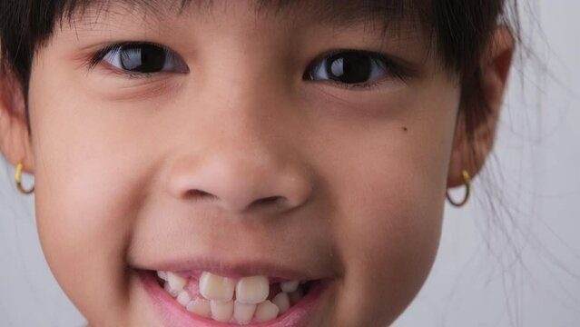 Close-up of cute young girl smiling wide, showing empty space with growing first front teeth. Little girl with big smile and missing milk teeth. Dental hygiene concept