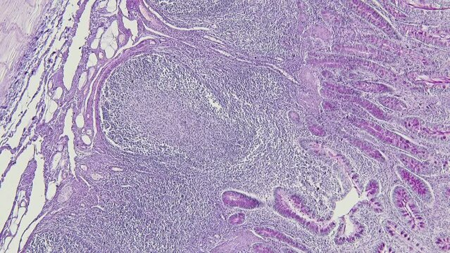 Backgrounds of Characteristics Tissue Tongue, Small intestine of Cat and Tissue of Esophagus rabbit under microscope.