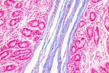 Backgrounds of Characteristics Tissue of Human under microscope in biology lab. - obrazy, fototapety, plakaty