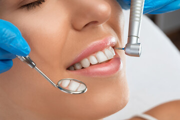 A dentist doctor treats caries on a tooth of a young beautiful woman in a dental clinic. Tooth filling.