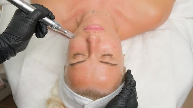 Close-up portrait of a beautiful aged woman during microneedling with dermapen from a beautician.