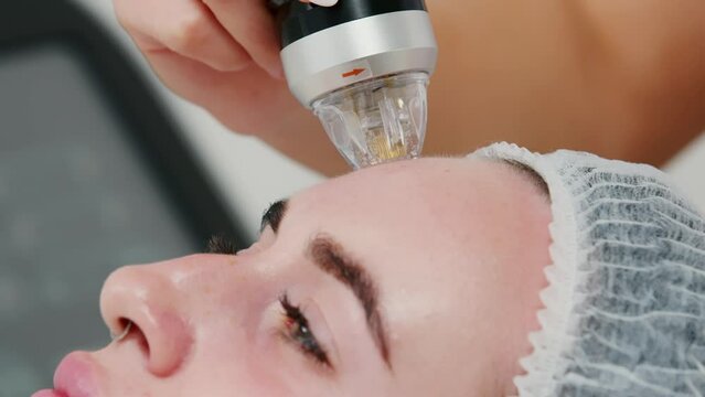 Young woman getting RF face lifting procedure at cosmetology clinic. Professional skincare, beauty treatment concept. Micro-Needle RF Lifting Neck Skin. 