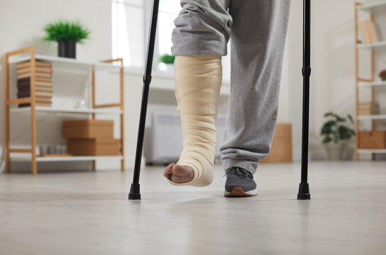 Man with fractured leg in cast standing with crutches at home, selective focus. Cropped view of plastered leg and crutches. Bone fracture, injury, trauma, recovery, rehabilitation concept