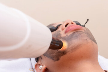 A young asian lady undergoes a laser carbon peel procedure at a skin or dermatologist clinic.