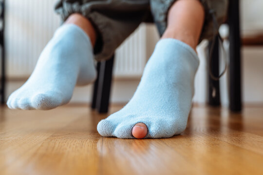 holey sock on teenager's foot